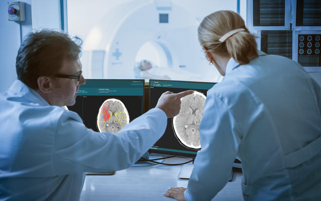 Brainomix Brain scan displayed on a computer screen